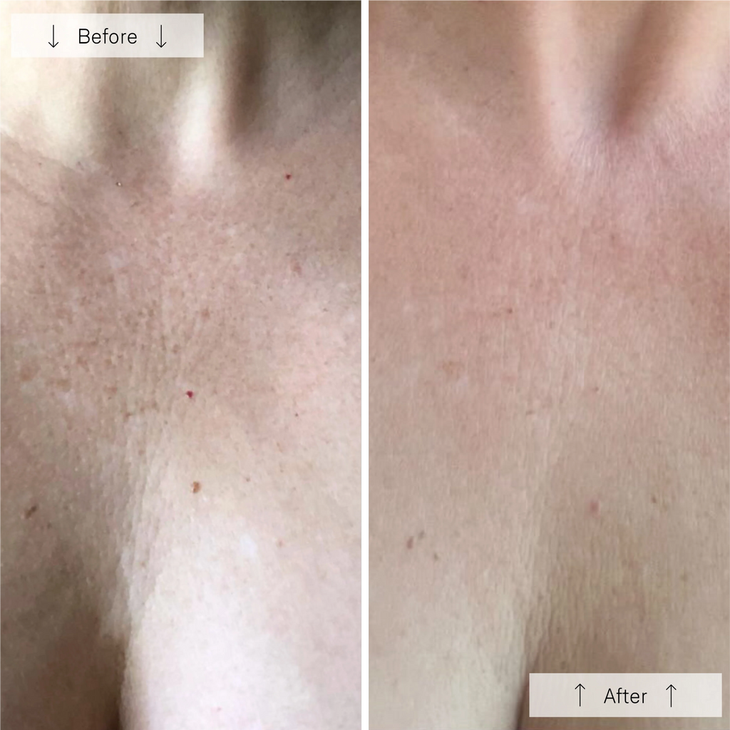 Omnilux Neck & Décolleté + Contour Glove Bundle