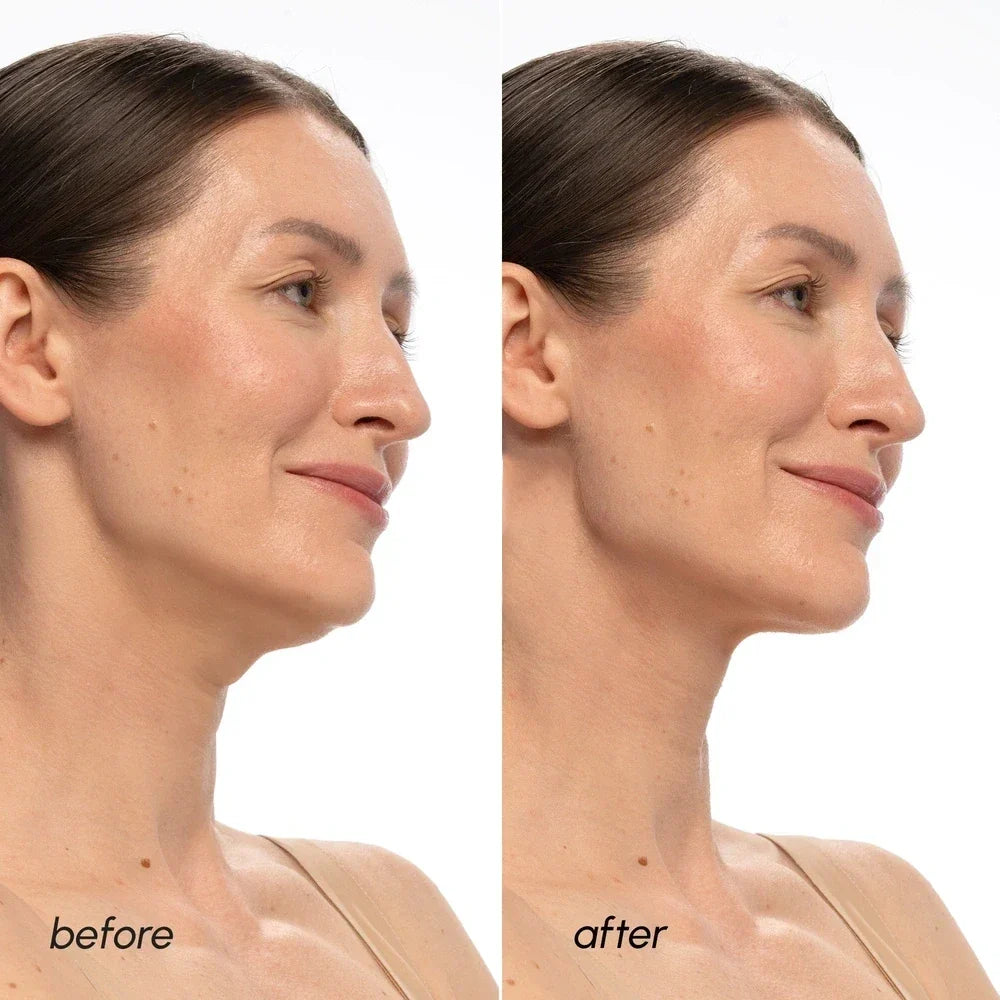 PDRN V-line Lifting Mask 20 PCS